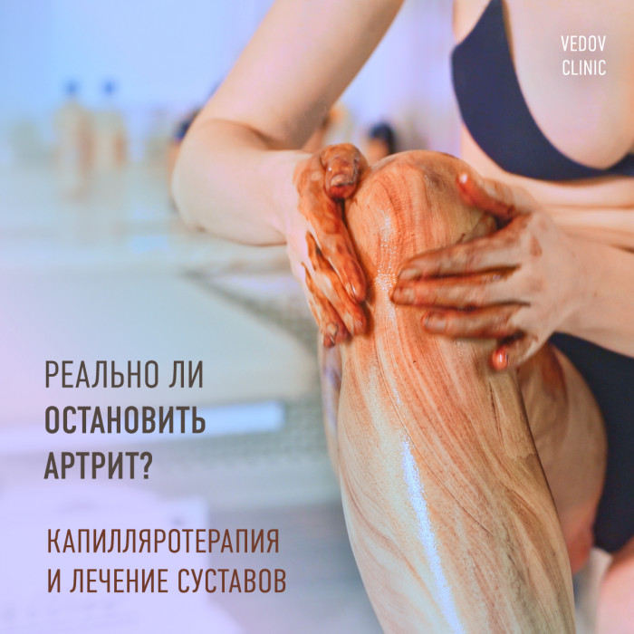 Капилляротерапия — вторая жизнь суставов